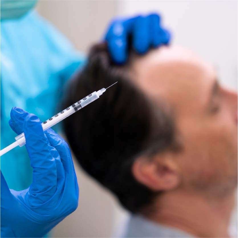 Best Hair PRP Treatment in Indore