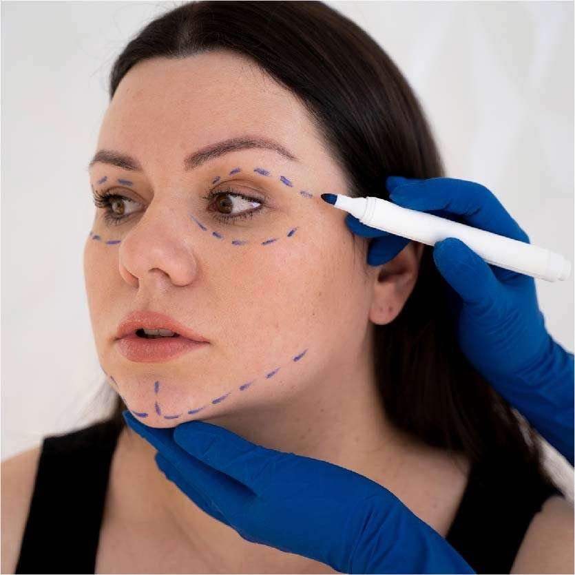 Best Thread Lift Treatment in Indore
