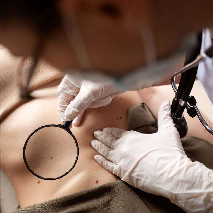 Scar Revision