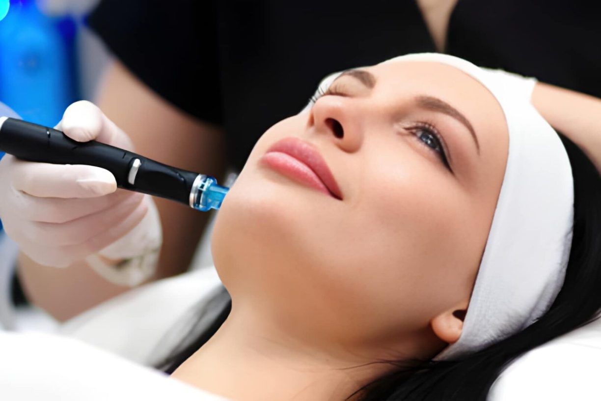 HydraFacial vs Chemical Peel: Which Is Better for Your Skin?